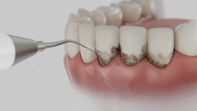 Reliable Wisdom Tooth Removal contractor in McIntosh County County, GA by Dentist Open Now